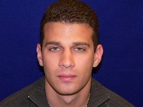 nose surgery rhinoplasty photos