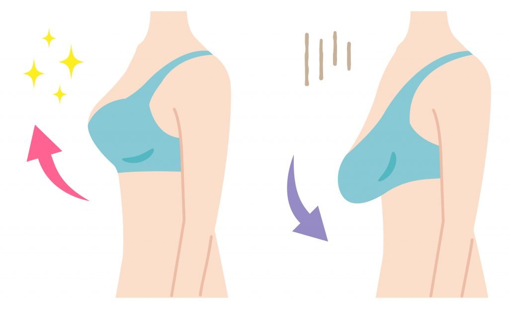 Breast Lift Mastopexy
