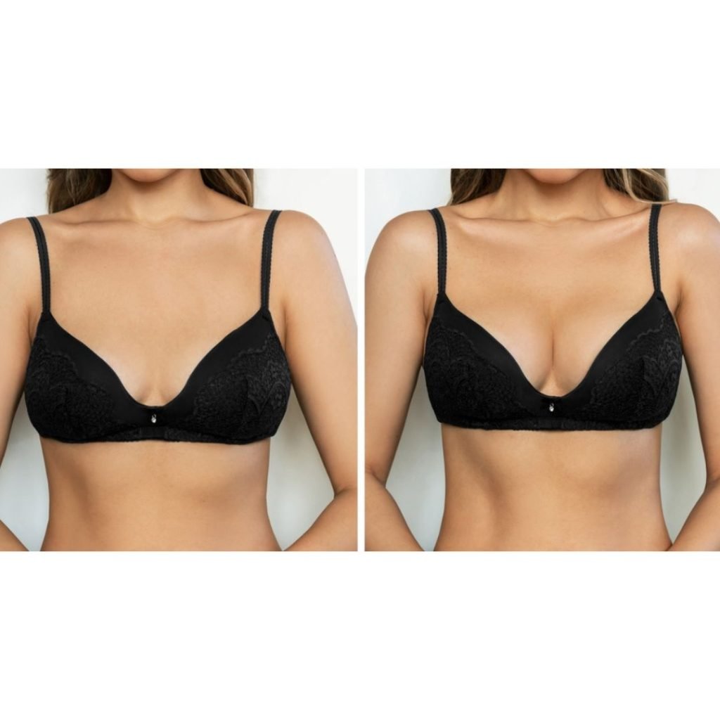 Breast Implants Bra