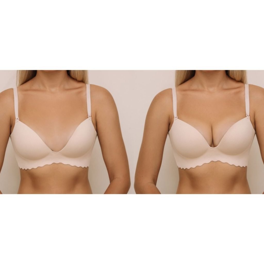Breast Augmentation Bra