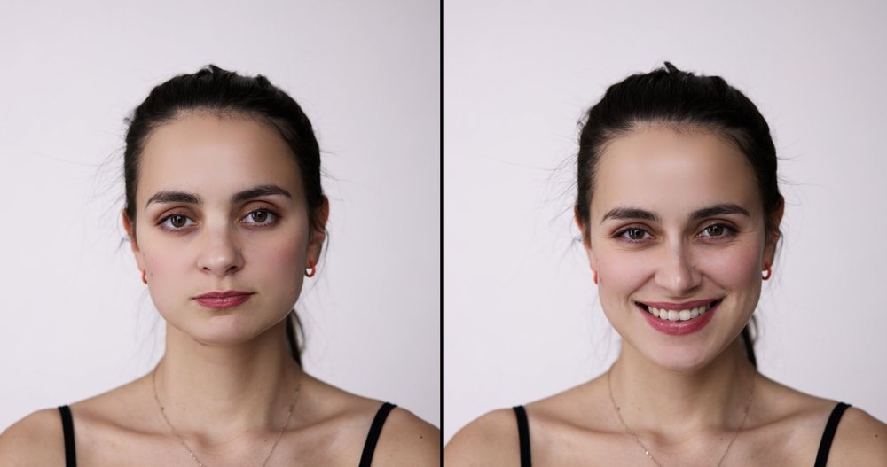 Best Rhinoplasty Surgeon Richmond VA