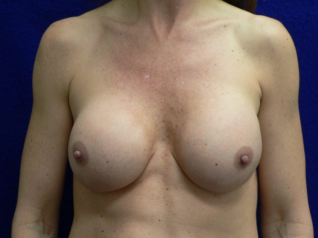 Older Male to Female Photos