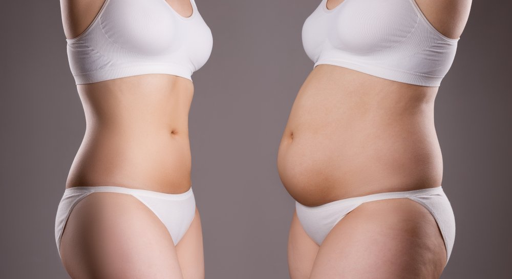 Mommy Makeover Near Me