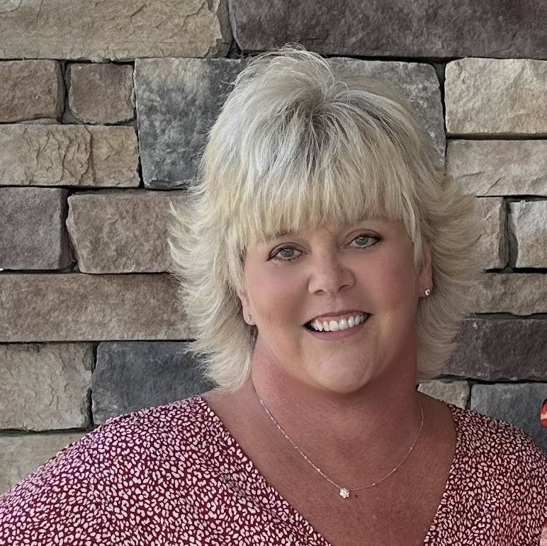 Claire's Facelift Story